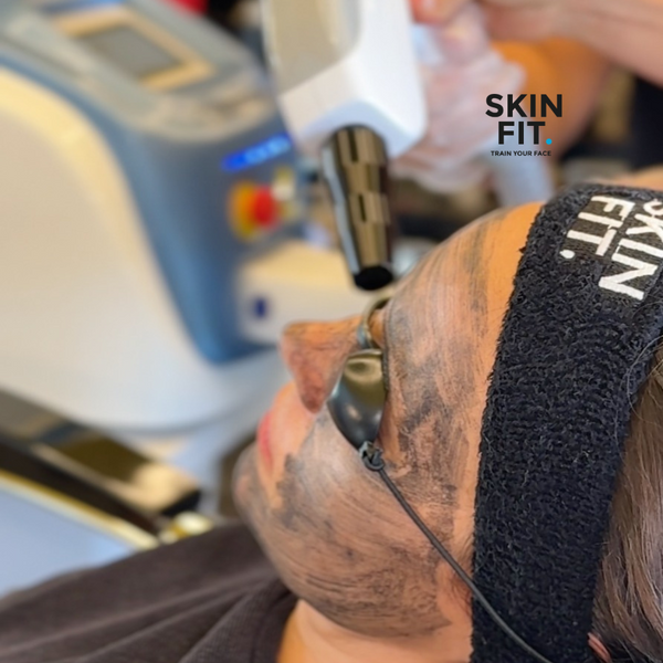 Pack 3 sesiones Láser