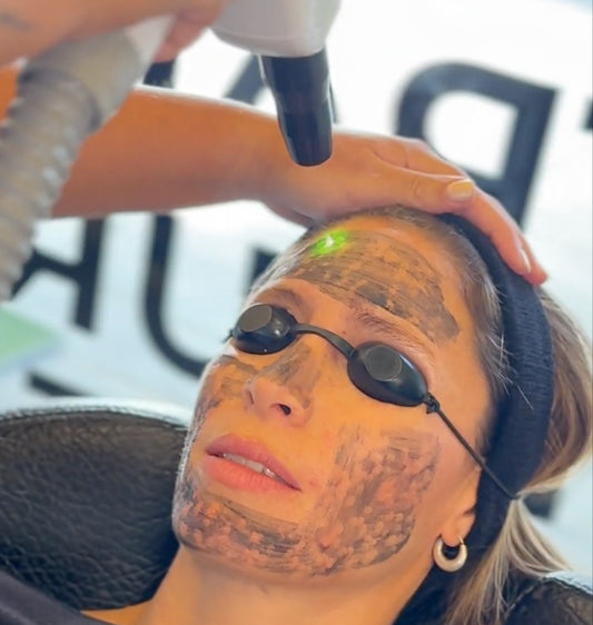 Láser hollywood peel